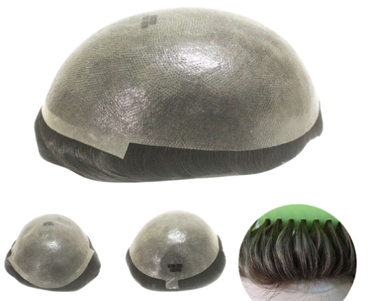 Prótese Capilar - HILTON N