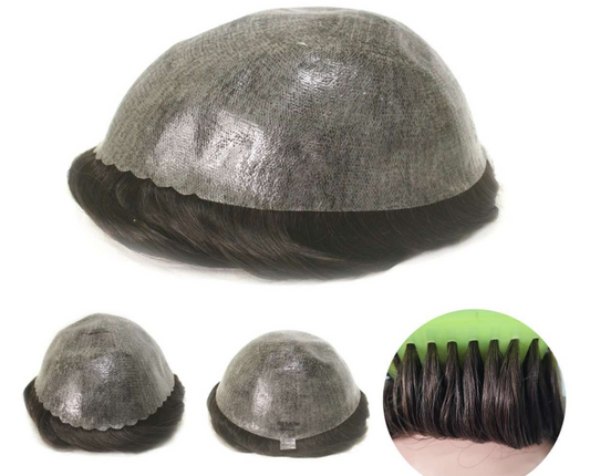 Prótese Capilar - FRED Injetada