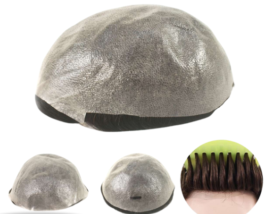 Prótese Capilar - HUGO S