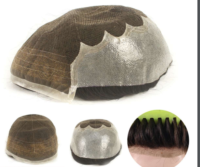 Prótese Capilar - FRANCESA N