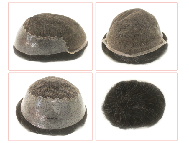 Prótese Capilar - FRANCESA