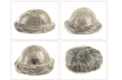 Prótese Capilar - FRED Injetada