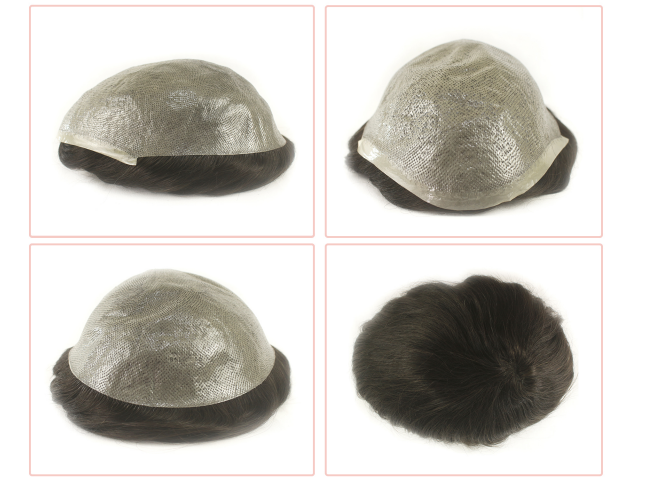 Prótese Capilar - HUGO S